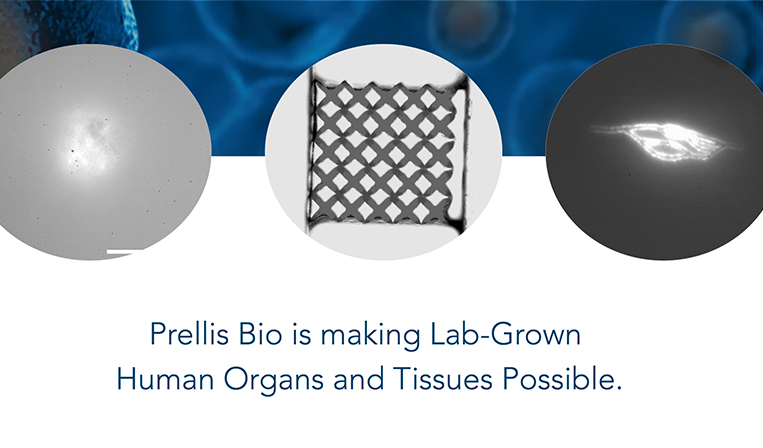 3Dプリンティング技術で人工臓器の開発を目指すPrellis Biologics